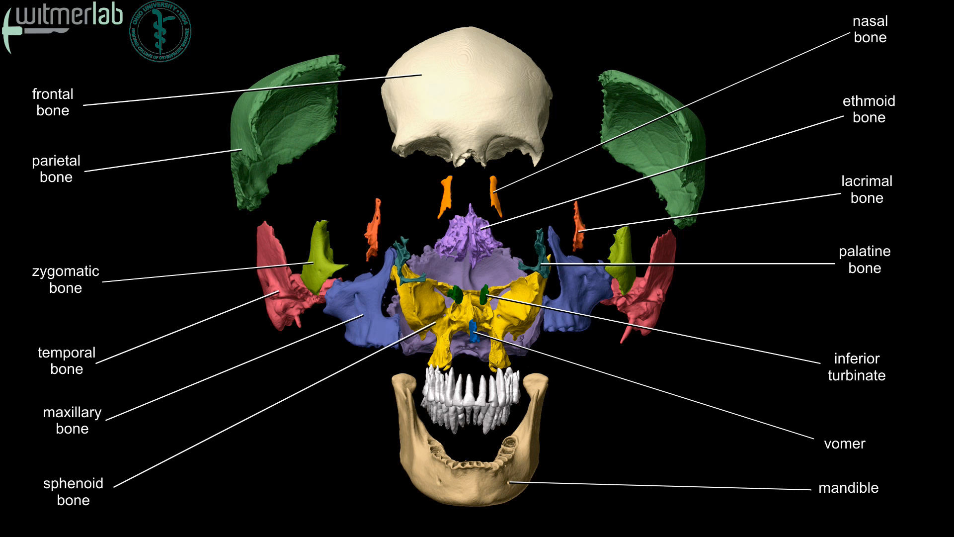 cranial bones labeled
