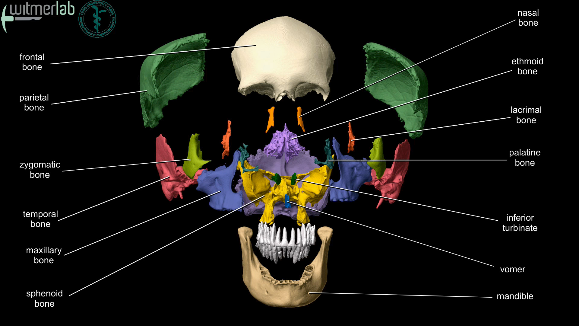 The Skull: Names of Bones in the Head, with Anatomy, & Labeled Diagram